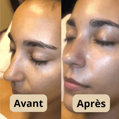 Peel Shot Coréen - Élimine les Impuretés et Sublime Votre Peau