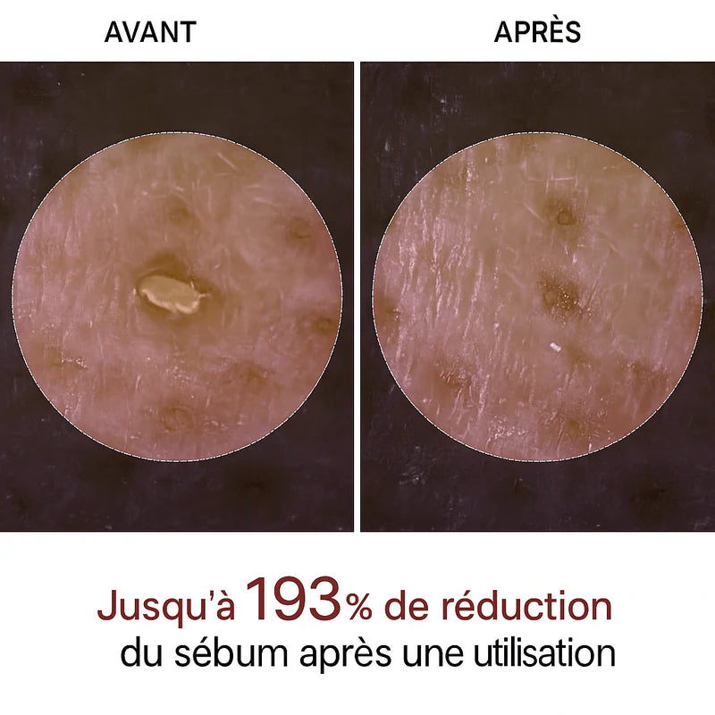 Peel Shot Coréen - Élimine les Impuretés et Sublime Votre Peau