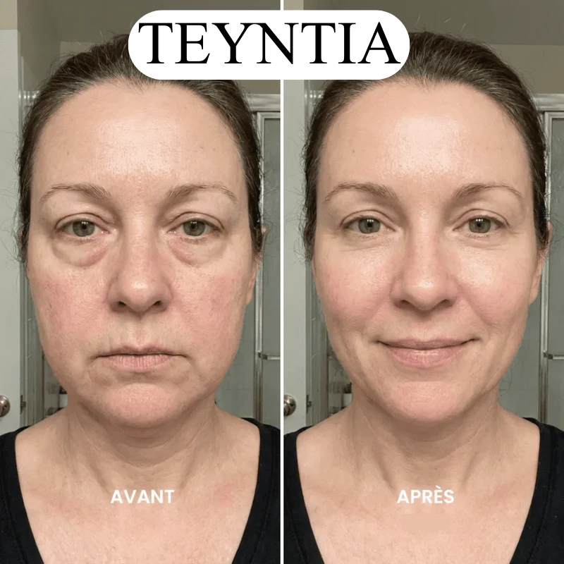 TEYNTIA - Brosse de drainage lymphatique
