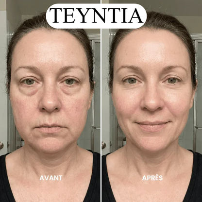 TEYNTIA - Brosse de drainage lymphatique